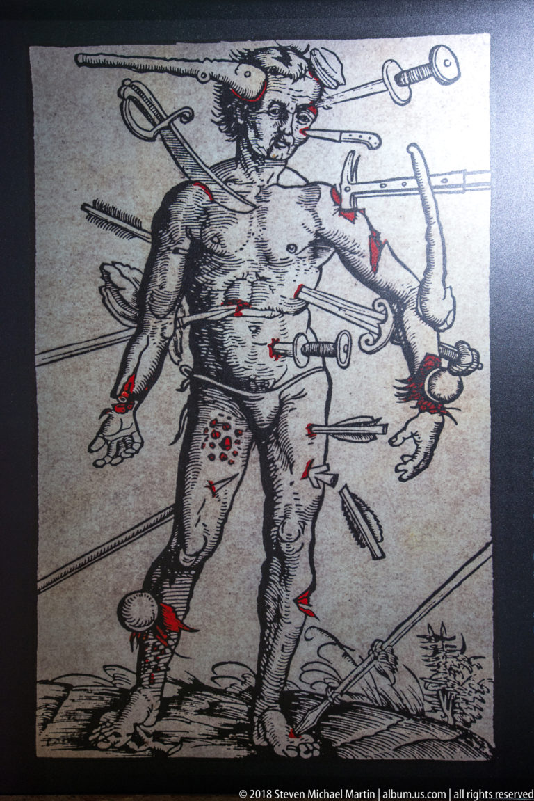Historical black-and-white combat illustration of a wounded fighter struck by swords, arrows, and other weapons, with red marks at injuries.