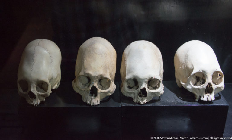 Four human skulls with elongated cranial shapes displayed side by side in a dark museum case.
