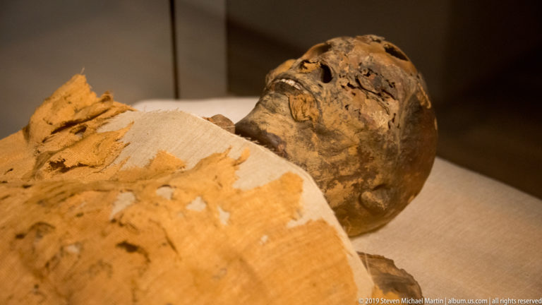 Partially wrapped human mummy with exposed darkened face and head above torn pale linen wrappings.