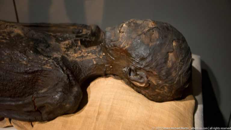 Unwrapped human mummy resting on a padded support, with exposed head, ear, shoulder, and desiccated upper torso.
