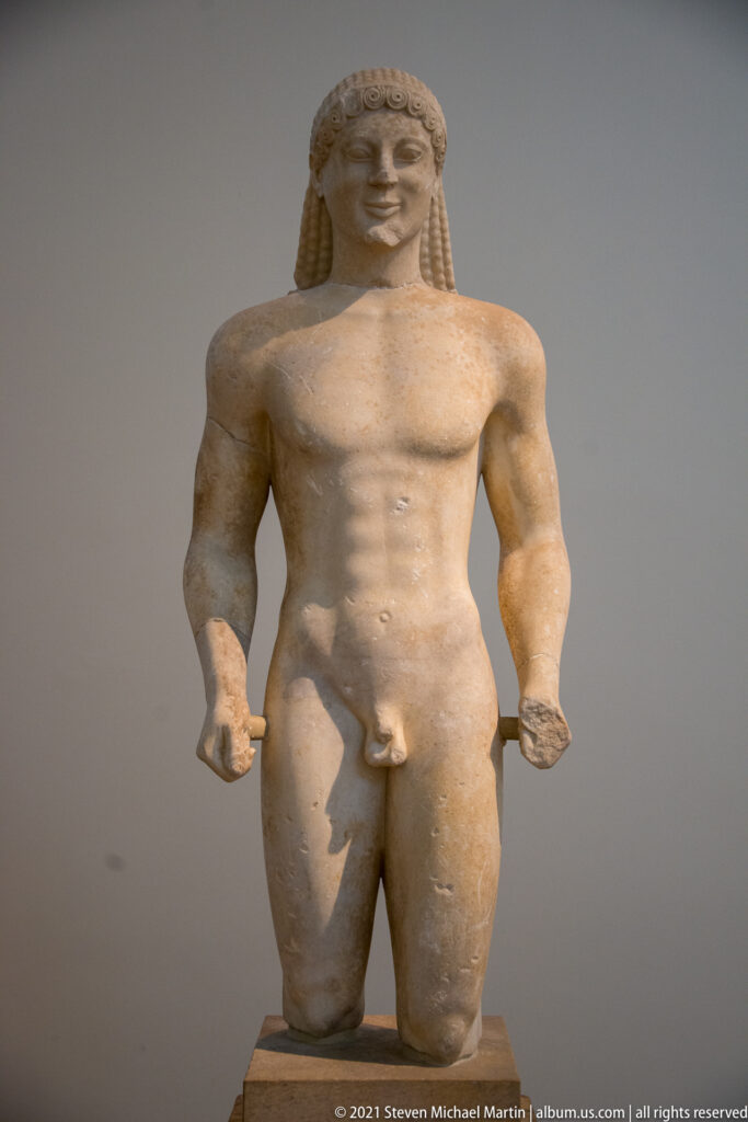 Fragmentary kouros with patterned hair, muscular torso, broken forearms, and one missing lower leg.