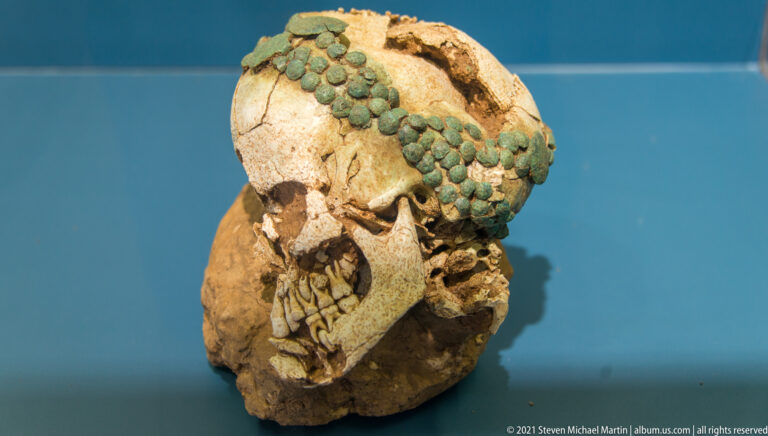 Human skull with teeth preserved and a row of small green circular metal pieces across the forehead and temple.