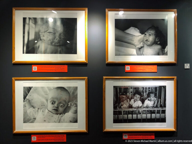 Four framed black-and-white portraits of infants and children with disabilities.