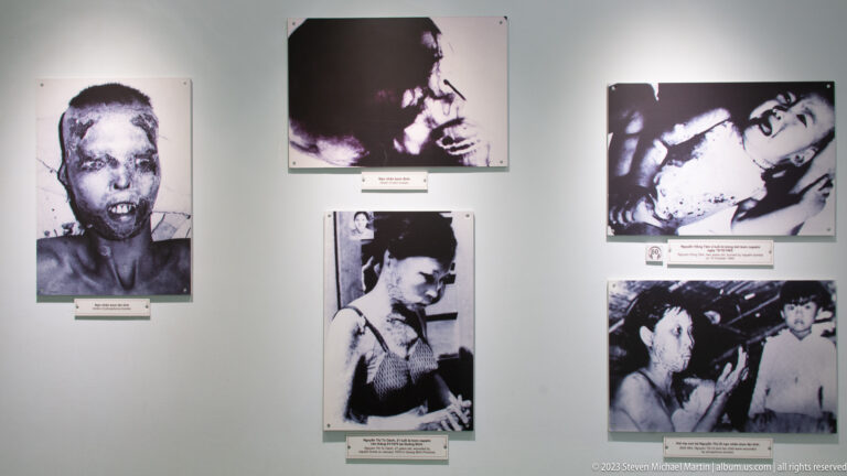 Black-and-white portraits of civilians with severe burns and facial injuries.