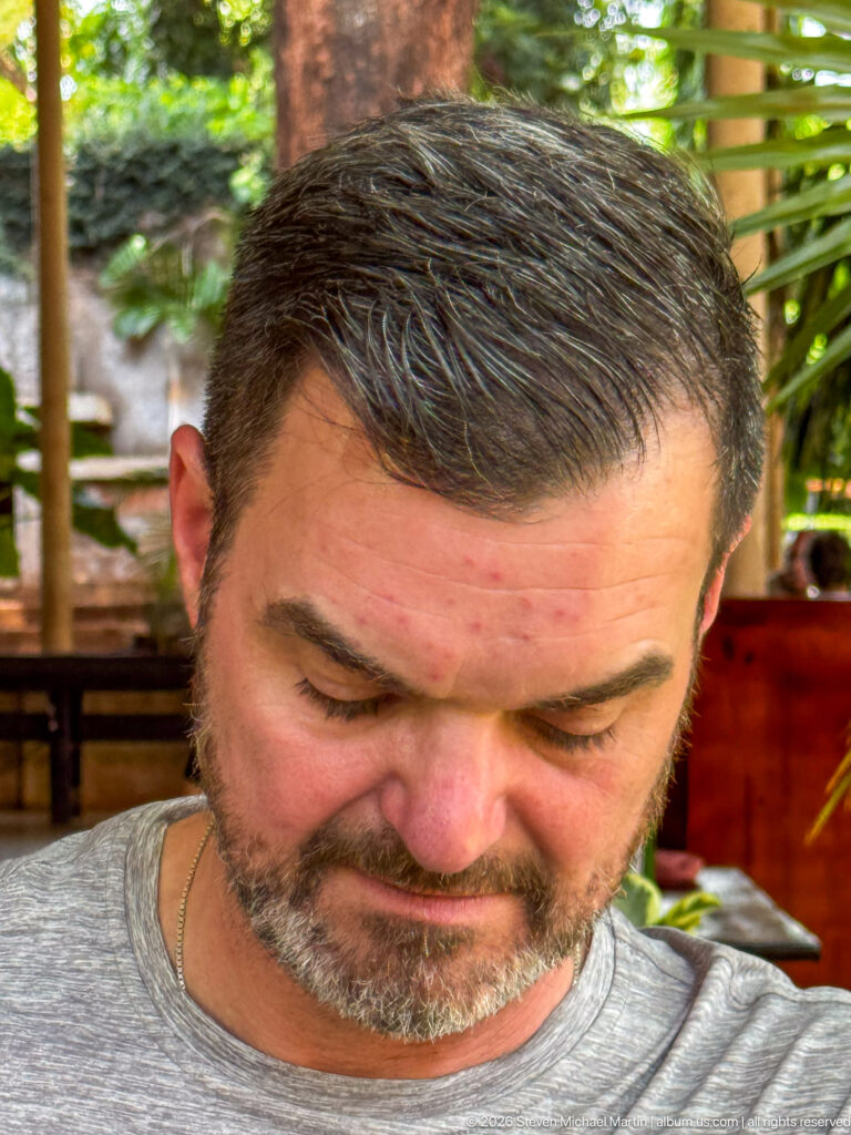 Close-up of a bearded man looking downward, with softly blurred restaurant seating and greenery behind him.