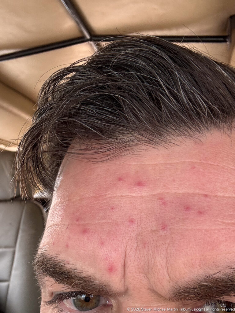 Extreme close-up of a traveler’s forehead, hair, eyebrow, and one eye beneath a safari vehicle roof.
